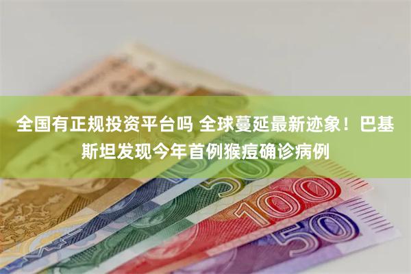 全国有正规投资平台吗 全球蔓延最新迹象！巴基斯坦发现今年首例猴痘确诊病例